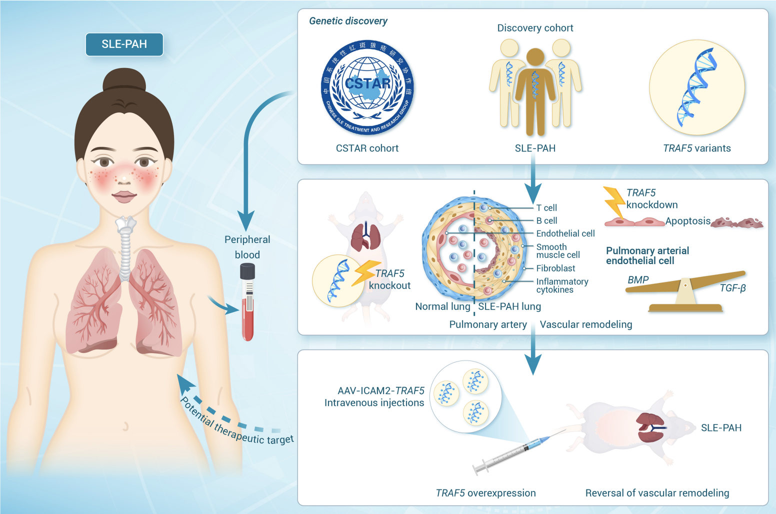 The Innovation | CSTAR队列研究揭示：TRAF5 罕见变异加重系统性红斑狼疮相关肺动脉高压
